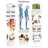 Fabrication Enterprises Anatomical Chart - Osteoporosis, Laminated FNT12-4615L
