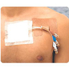 Cath-Strip Reclosable Catheter Fastener, 50/BX