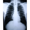 Clear Choice Performance X-Ray Film