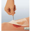 Cuticerin Impregnated Dressing (66045561)