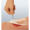 Cuticerin Impregnated Dressing (66045560)