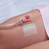 Catheter Holder Hold-n-Place One Size Fits All, Adhesive Patch, 1/EA