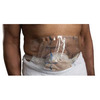 Wound Protector AquaGuard Adhesive, 5 EA/PK