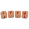 Pressure Ulcer / Bedsore Model Life/form, 1/EA