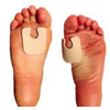 J-18 Callus Pad, One Size Fits Most Adhesive Foot